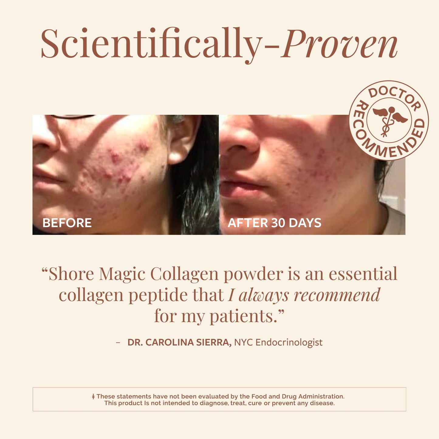 Shore Magic Marine Collagen Powder – Types I-IV, Unflavored, 9g Protein