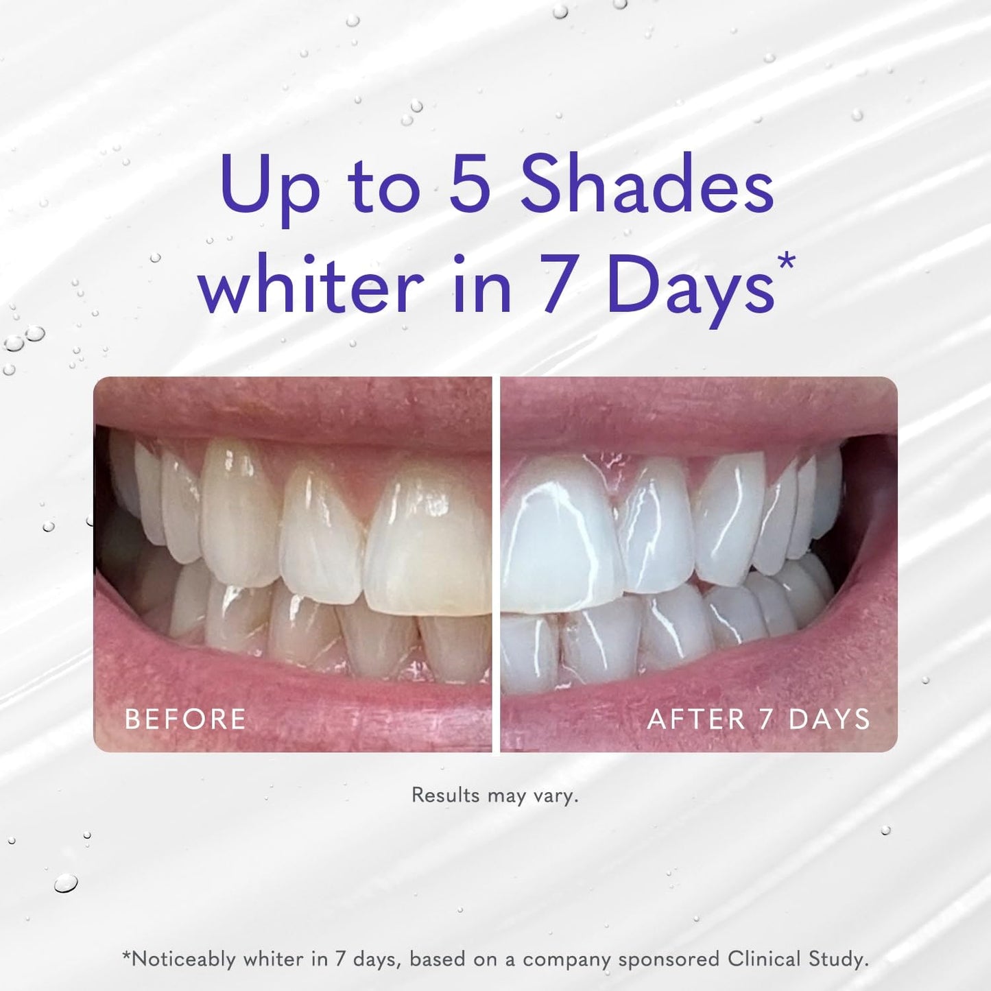 Smileactives Pro Whitening Gel – 2 oz Hydrogen Peroxide Toothpaste Whitening