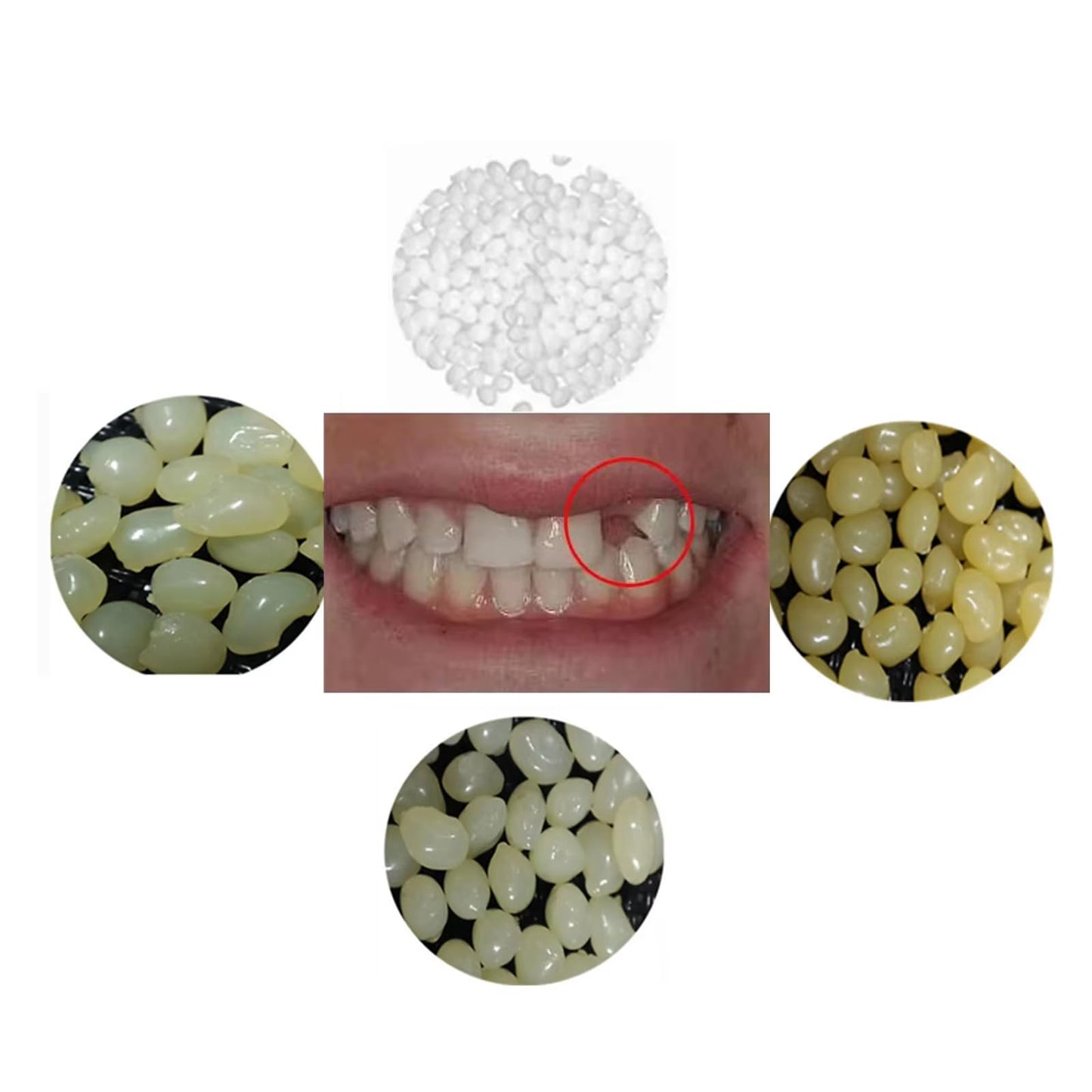 Sowsmile 4-Color Temporary Moldable Teeth Repair Beads Kit