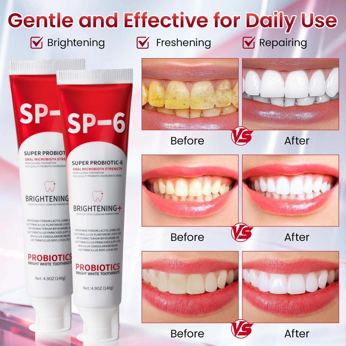 SP-6 Probiotic Whitening Toothpaste – 6 Probiotics, Enamel-Safe, Fluoride-Free, Fresh Mint