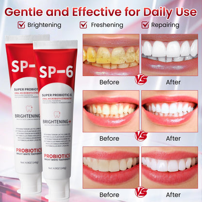 SP-6 Probiotic Whitening Toothpaste – 6 Probiotics, Enamel-Safe, Fluoride-Free, Fresh Mint