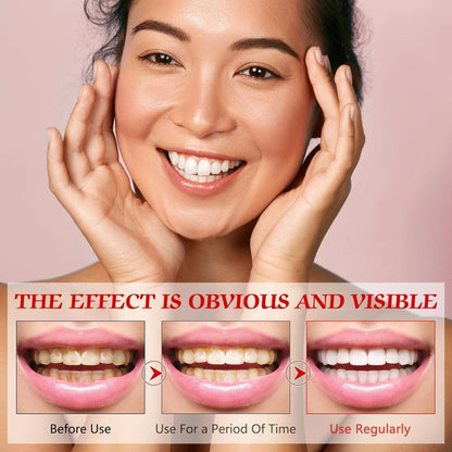 SP-6 Probiotic Whitening Toothpaste – Fluoride Free, Mint, Sensitive Teeth