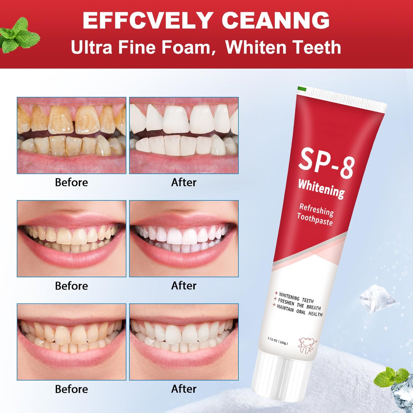 Sp8 Probiotic Brightening Toothpaste – SP-8 Ultra Whitening, 2 Tubes + 2 Toothbrushes