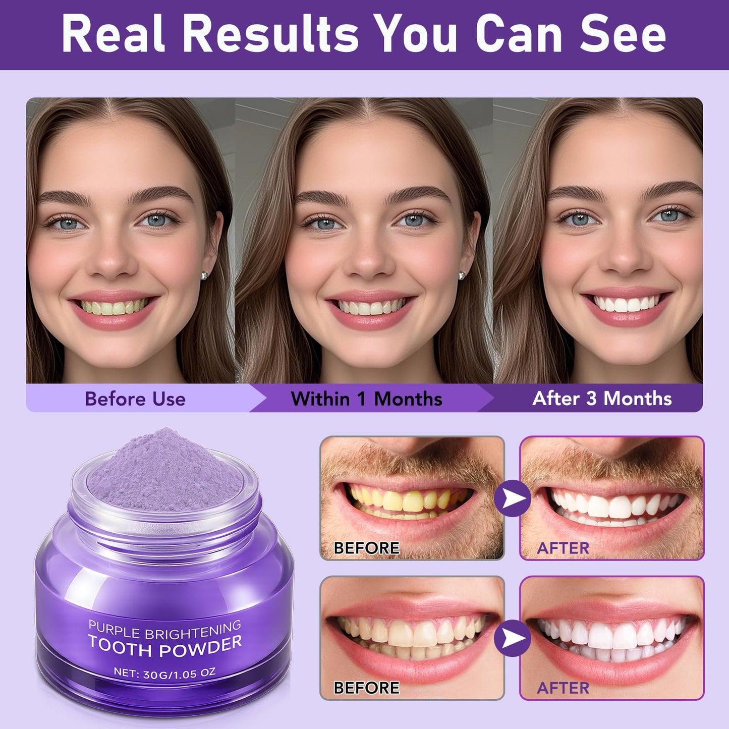 Teeth Whitening Powder – Enamel-Safe Brightening with PAP (Peroxide-Free)