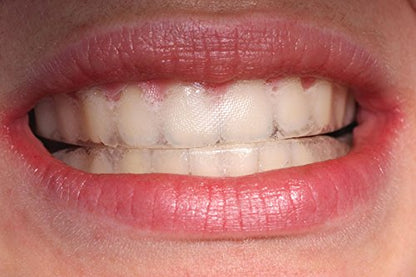 Teeth Whitening Tray Ultra White – 0.75mm Ultra Thin Moldable Trays with Storage Case