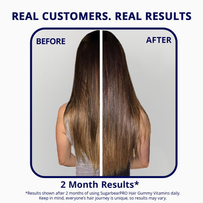 SugarBearPro Hair Vitamin Gummy – Extra Strength Biotin 6000mcg (6-Month Supply) | Vegan, Kosher, Halal, Cruelty-Free