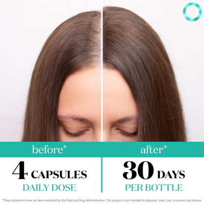 Superfood MD Women’s Balance Hair Growth – 2 Month Soy-Free Formula for 45+