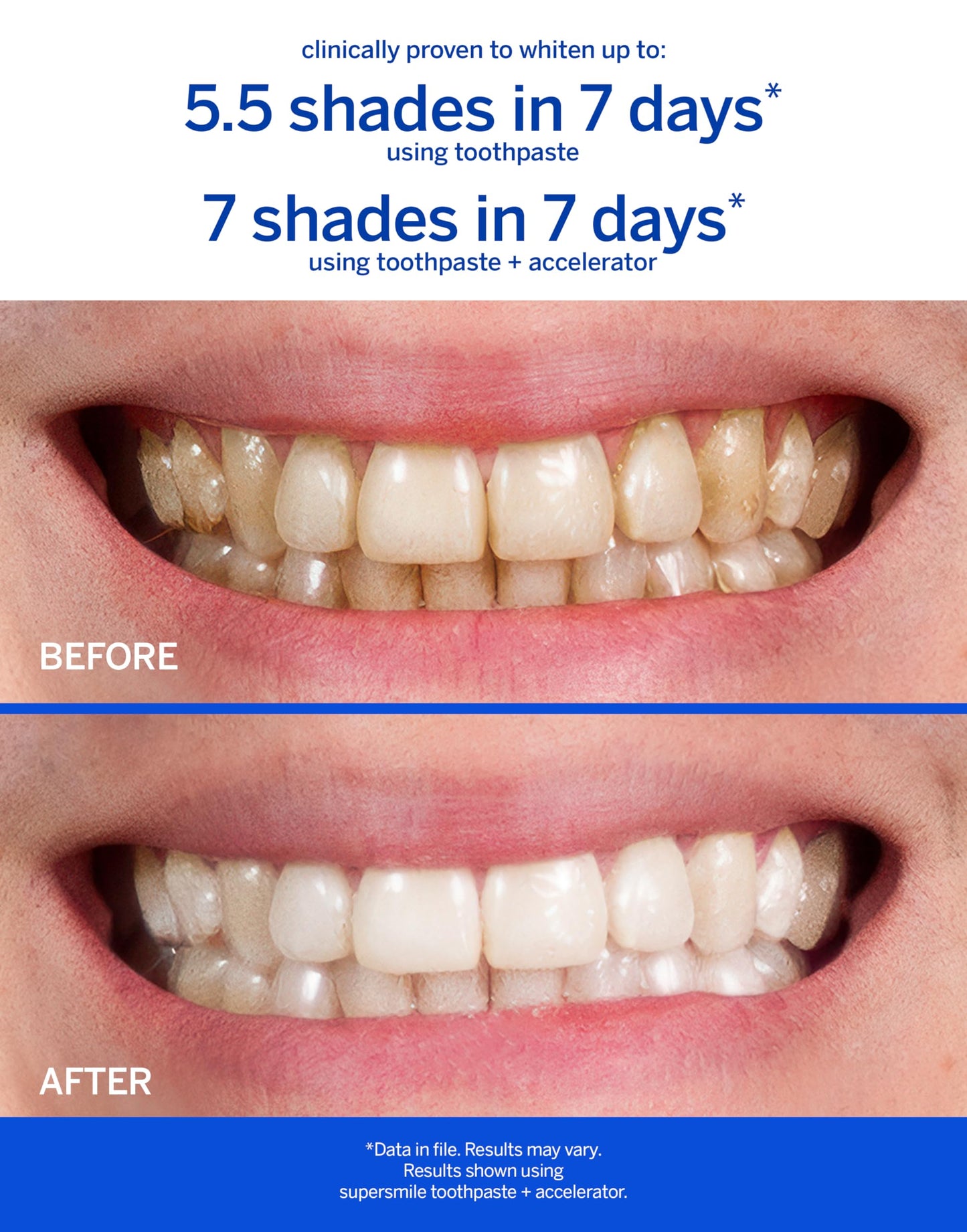 Supersmile Pro Whitening Toothpaste with Fluoride - Whitens Teeth (6 Shades) | Enamel Strengthening | No Sensitivity | Travel Size Pack of 2