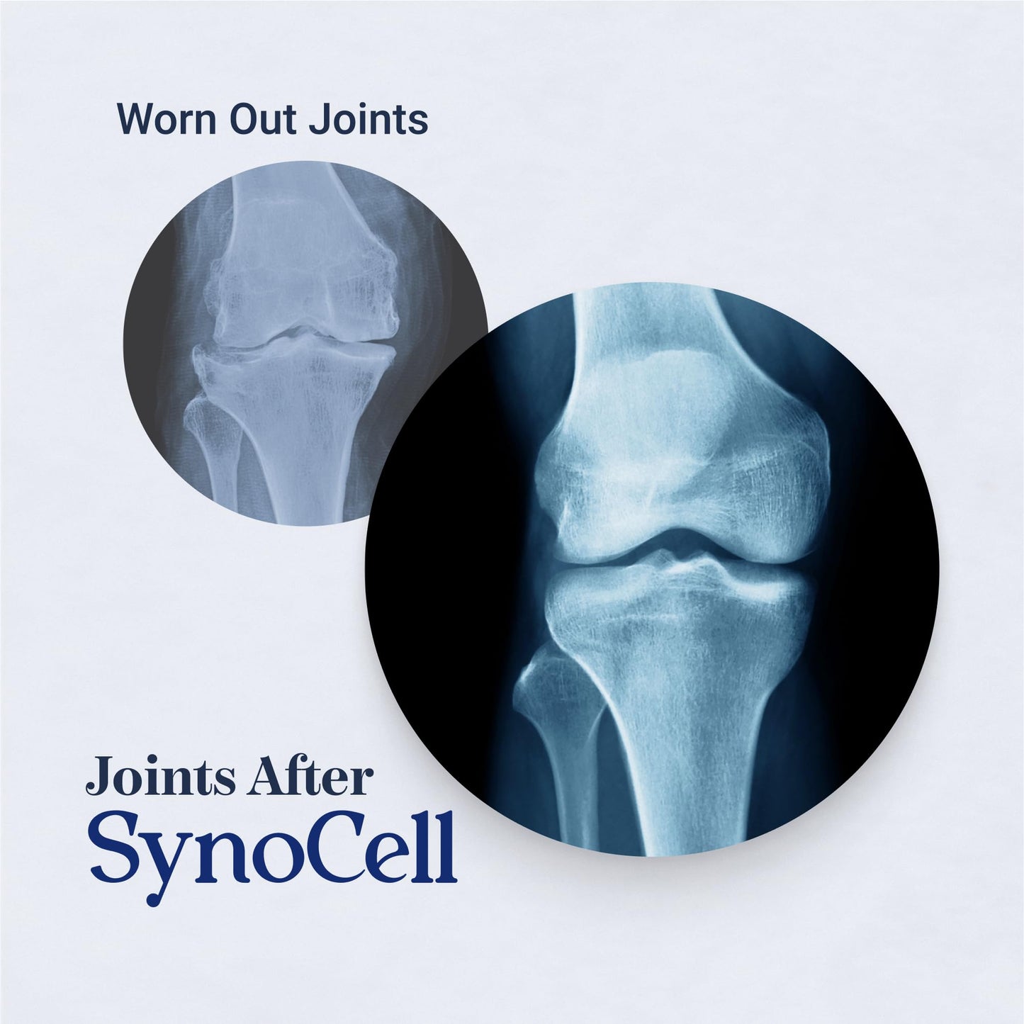 Synocell Glucosamine Chondroitin Complex – Joint Support with Boswellia, MSM & Quercetin