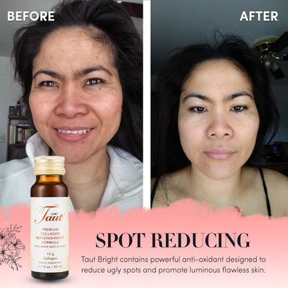 TAUT Liquid Collagen for Women – 13,000mg Marine Collagen + Hyaluronic Acid (8 Bottles)