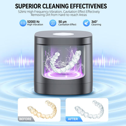 TEBAL Ultrasonic Retainer Cleaner – 52kHz, 250ml, for Retainers & More | Black