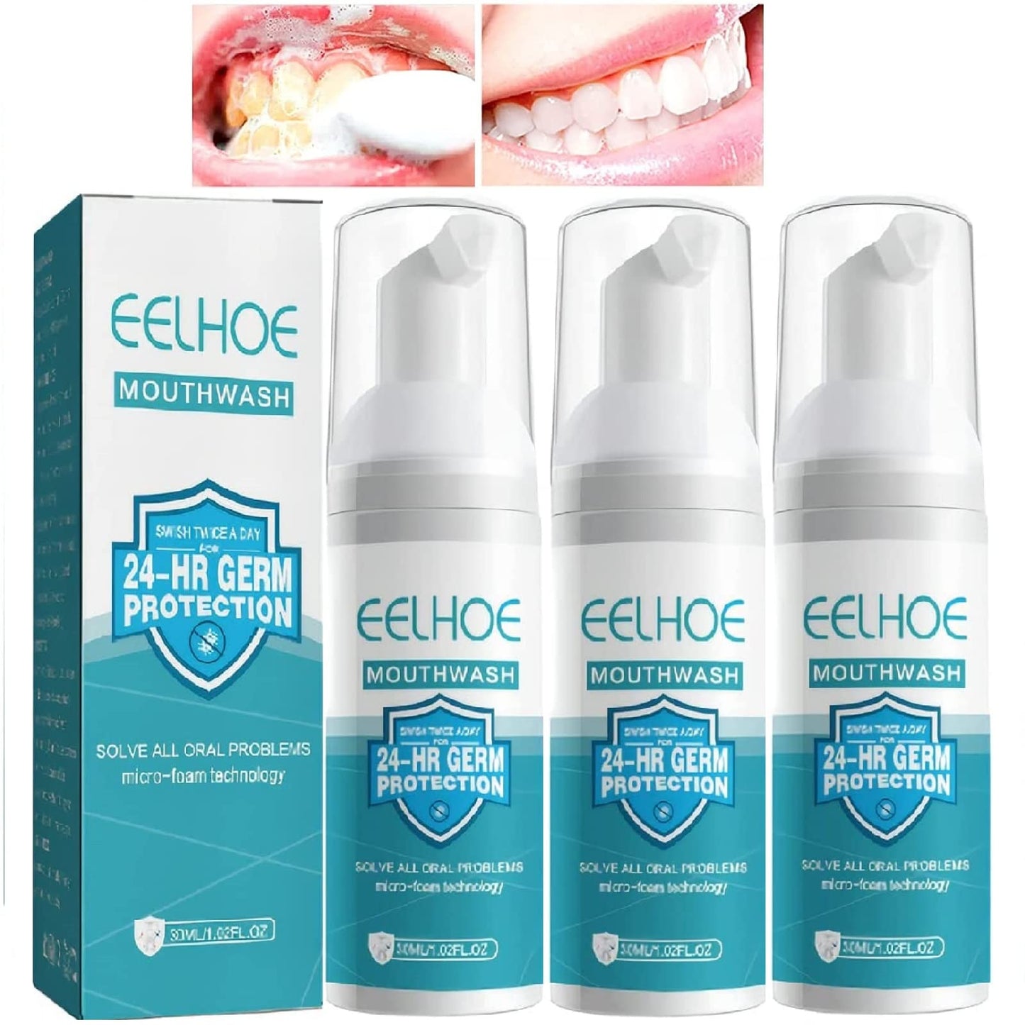 3Pcs Teeth Mouthwash Foam – Stain Removal & Fresh Breath (30ml x3)