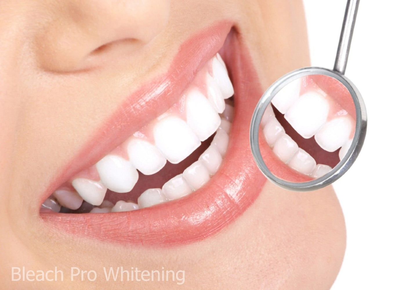 Teeth Whitening Gel Syringe 10ml - 44% Carbamide Peroxide - 4 Pack