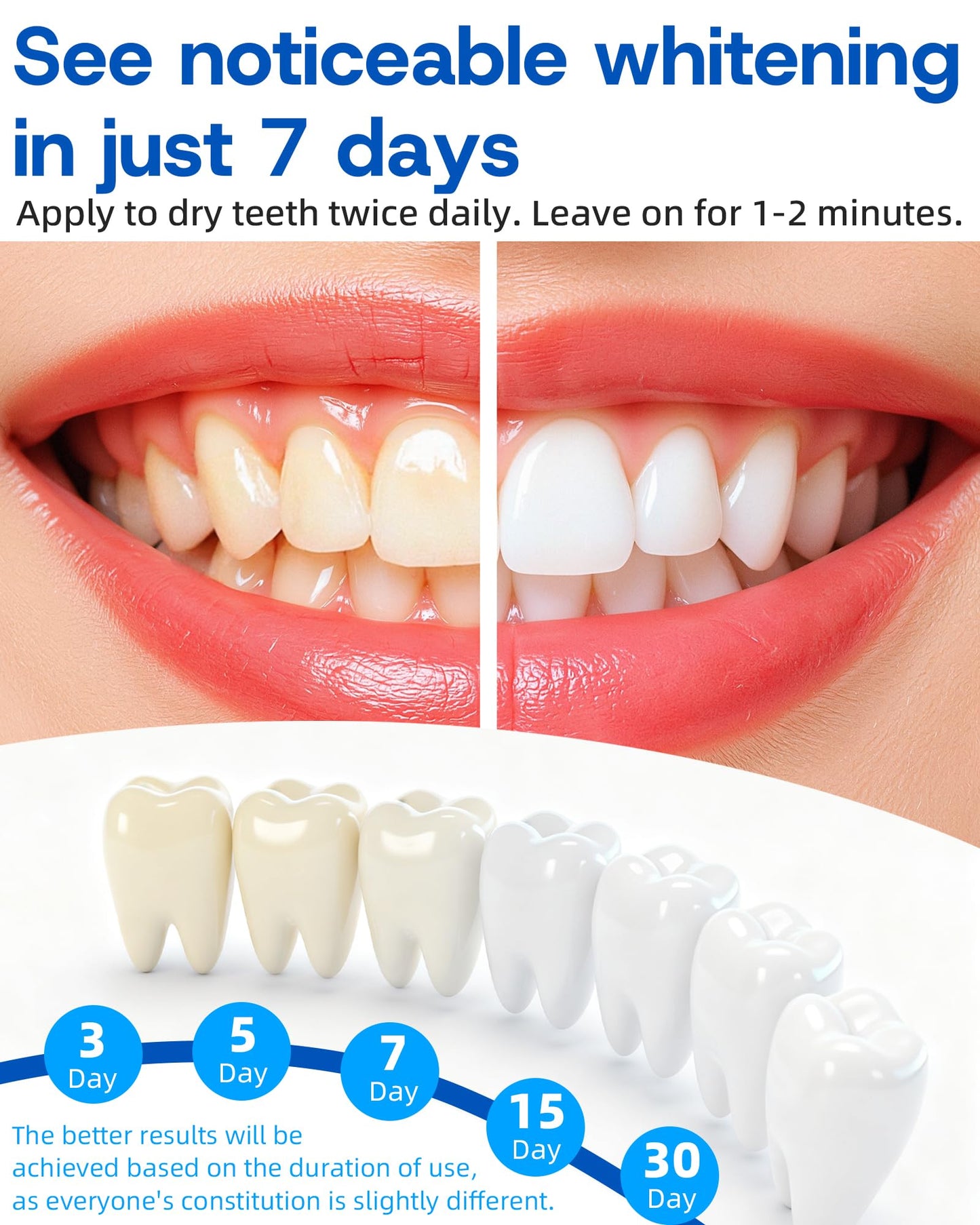 Teeth Whitening Pen 3 Pcs – 35% Carbamide Peroxide Gel, Gentle & Travel-Portable