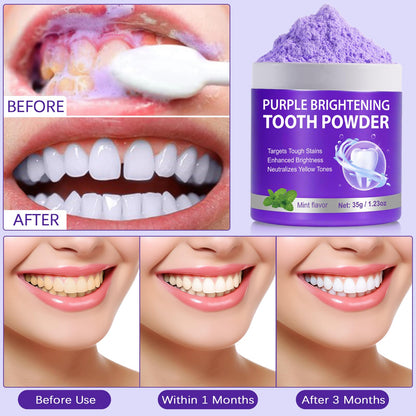 Teeth Whitening Powder & Booster – Enamel Safe, Sensitive Teeth, Fresh Breath (35g)