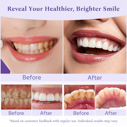 Hydroxyapatite Niacinamide Teeth Whitening Powder – Enamel Repair
