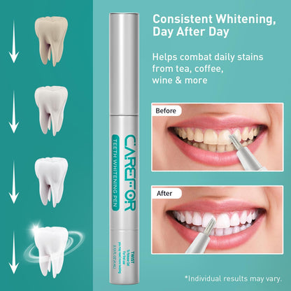 Teeth Whitening Pen 1 Pack (4ml) – Fast-Acting Gel with Brush | Travel Kit
