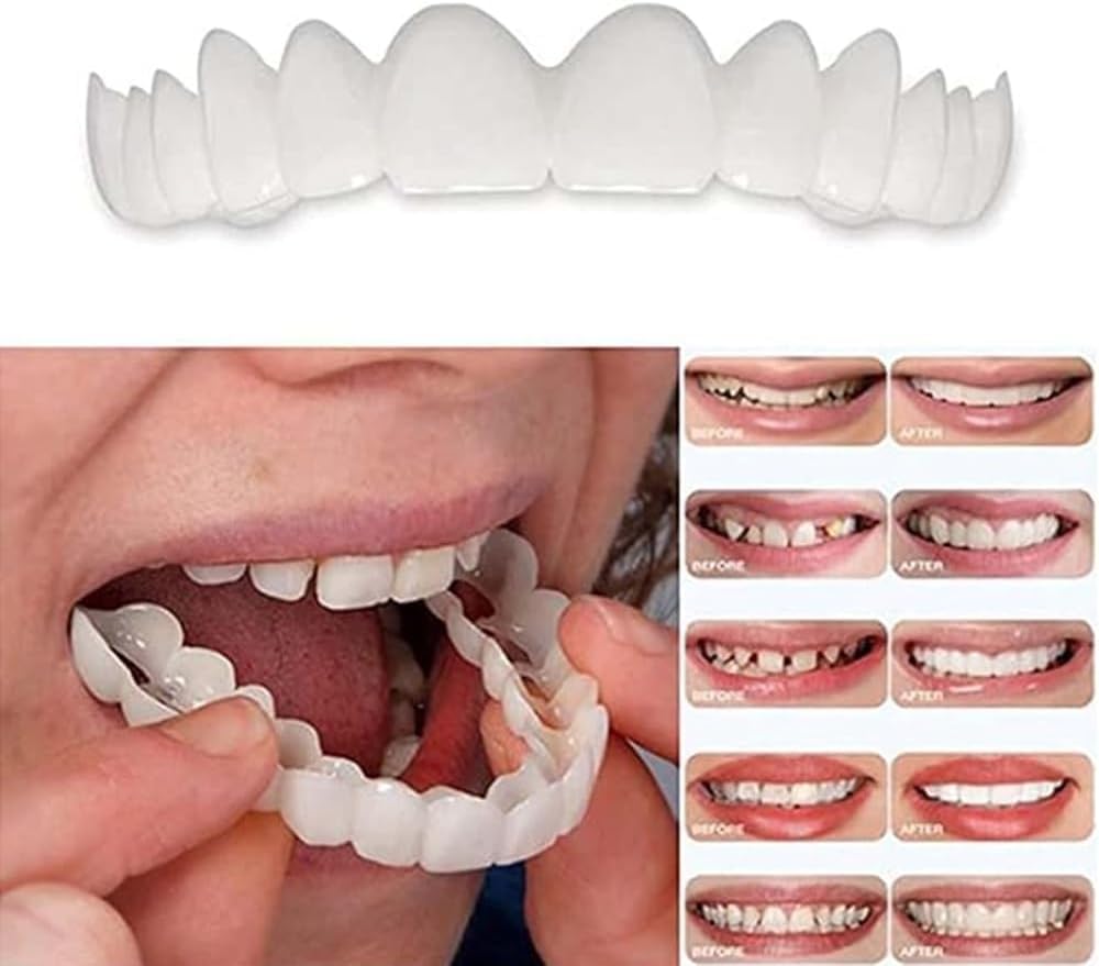 Temporary Smile Solution - 2 Pairs, Adjustable & Comfortable, Restores Confidence for All (1)