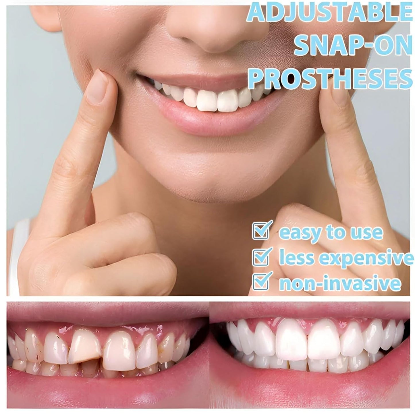 Temporary Veneer Kit for Men & Women - Adjustable, Natural & Comfortable (2/4 Piece Set)