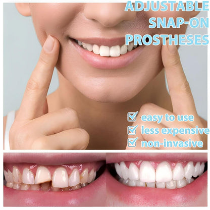 Temporary Veneer Kit for Men & Women - Adjustable, Natural & Comfortable (2/4 Piece Set)