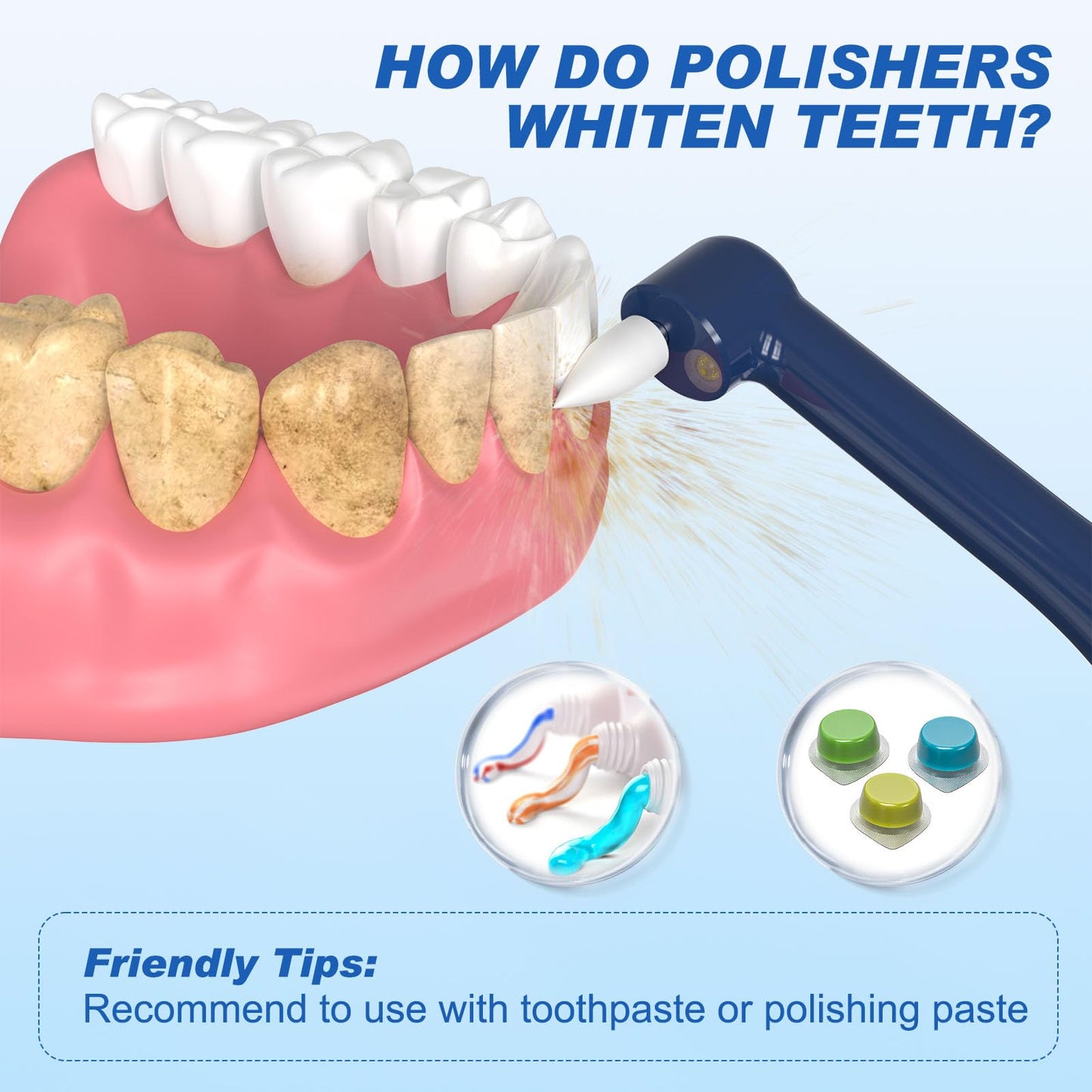 Tooth Polisher & Whitening Kit – 5 Heads, 4 Modes, LED Light, USB Rechargeable