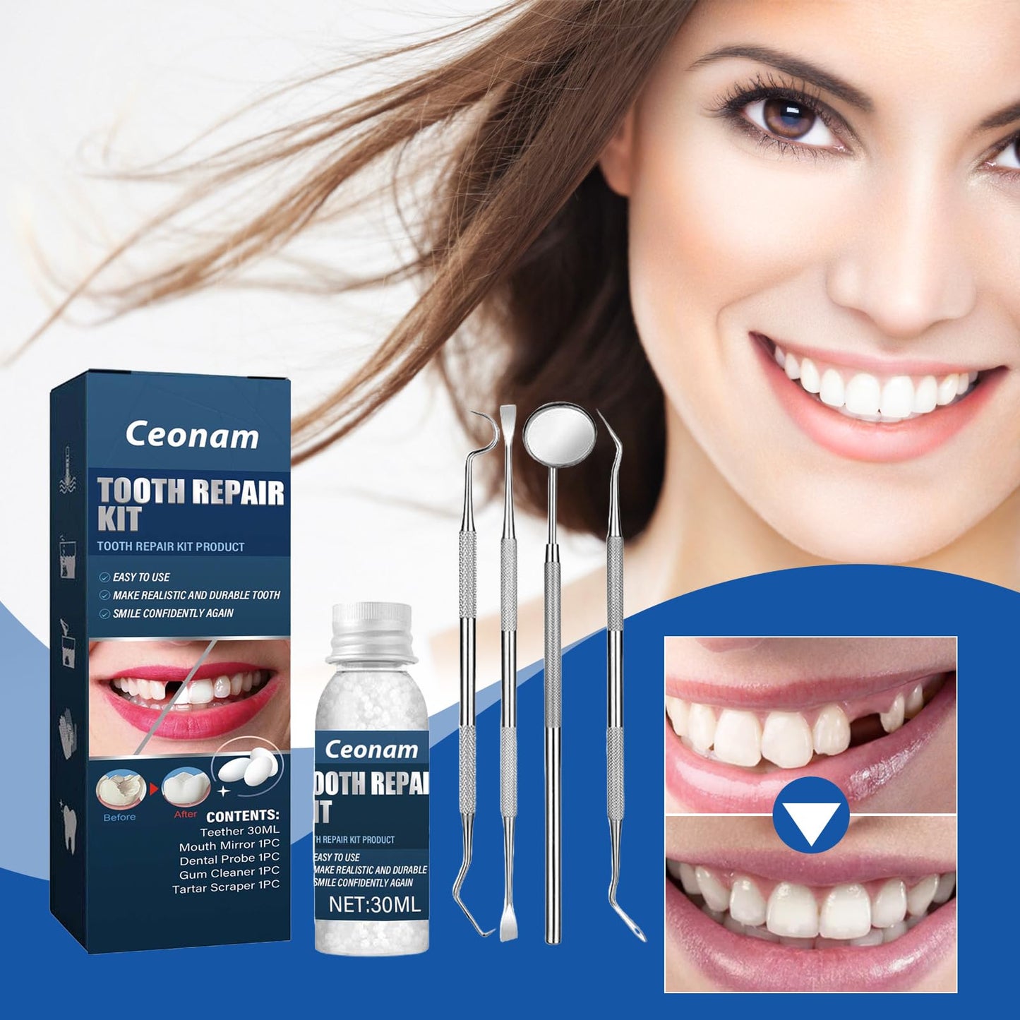 Tooth Repair Kit - Temporary Fake Teeth Replacement with Dental Mirror Tools | Ceonam