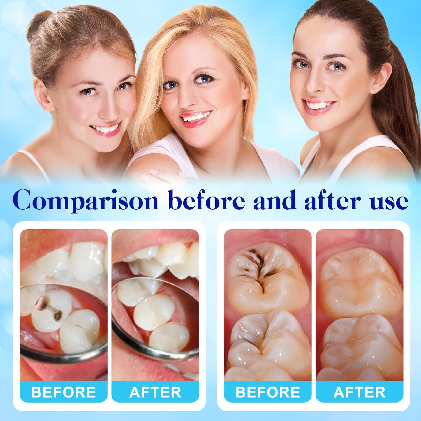 Tooth Repair Kit – Zinc Oxide Eugenol Cement for Temporary Teeth Restoration