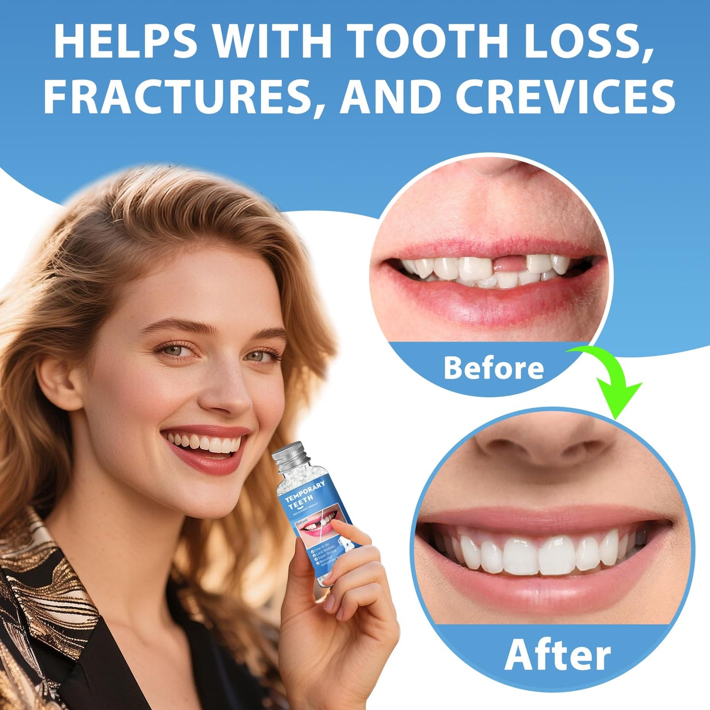 Tooth Repair Kit - Moldable Beads for Teeth Repair (DIY Denture, 1PCS-A)