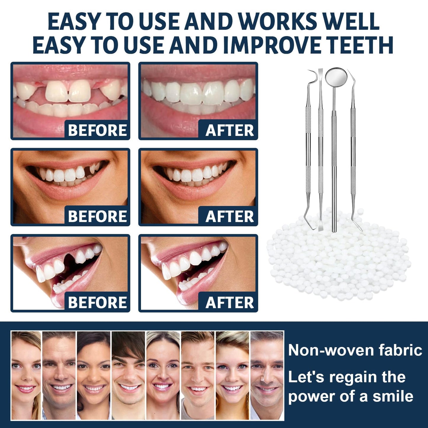 Tooth Repair Kit - Temporary Fake Teeth Replacement with Dental Mirror Tools | Ceonam