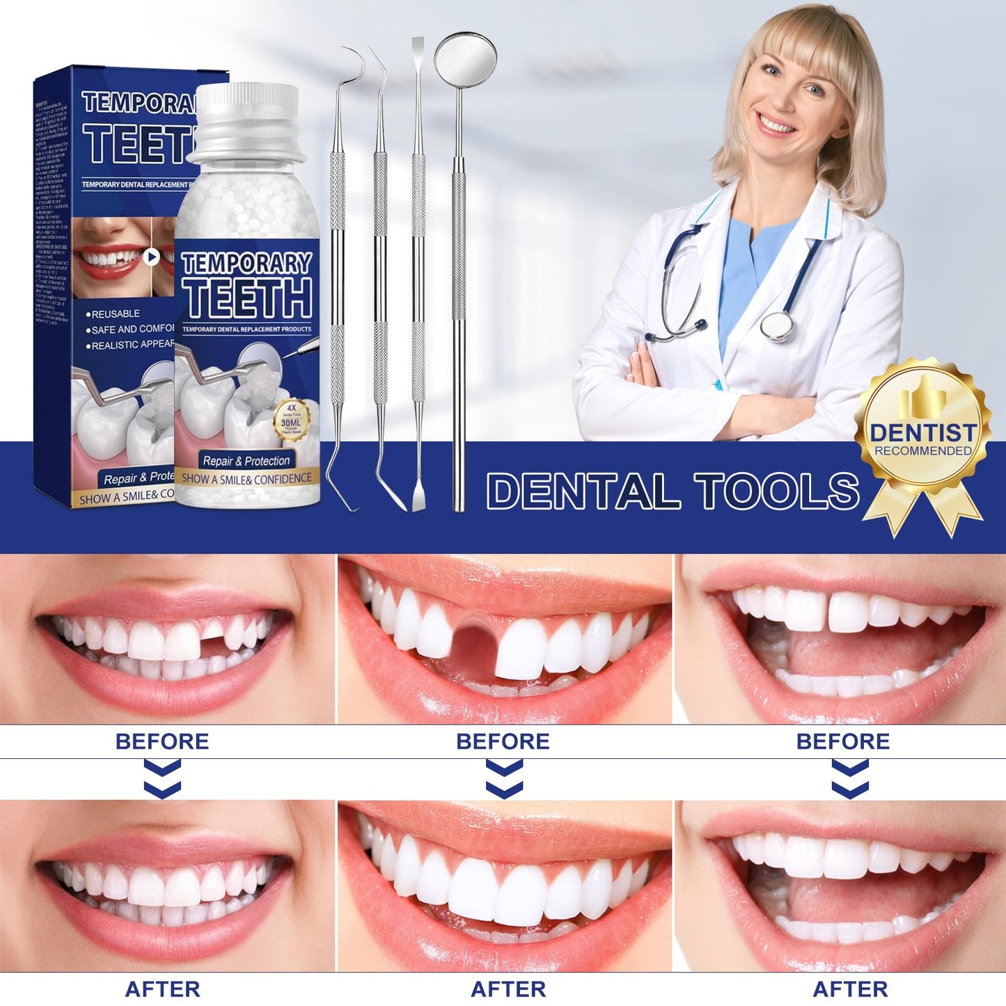 Tooth Repair Kit – Moldable Tooth Filling & DIY Dental Restoration