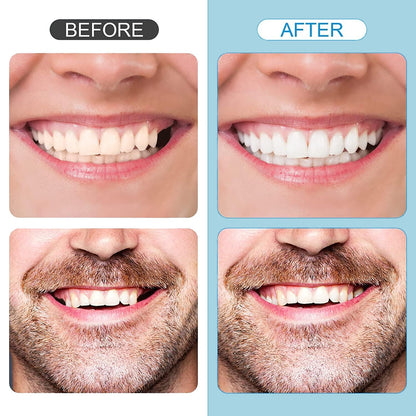 Tooth Repair Kit - Temporary Natural Shade Moldable Beads for DIY Tooth Replacement (6PCS)