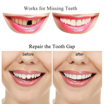 Tooth Repair Kit - Thermal Beads for Filling Gaps & Broken Teeth