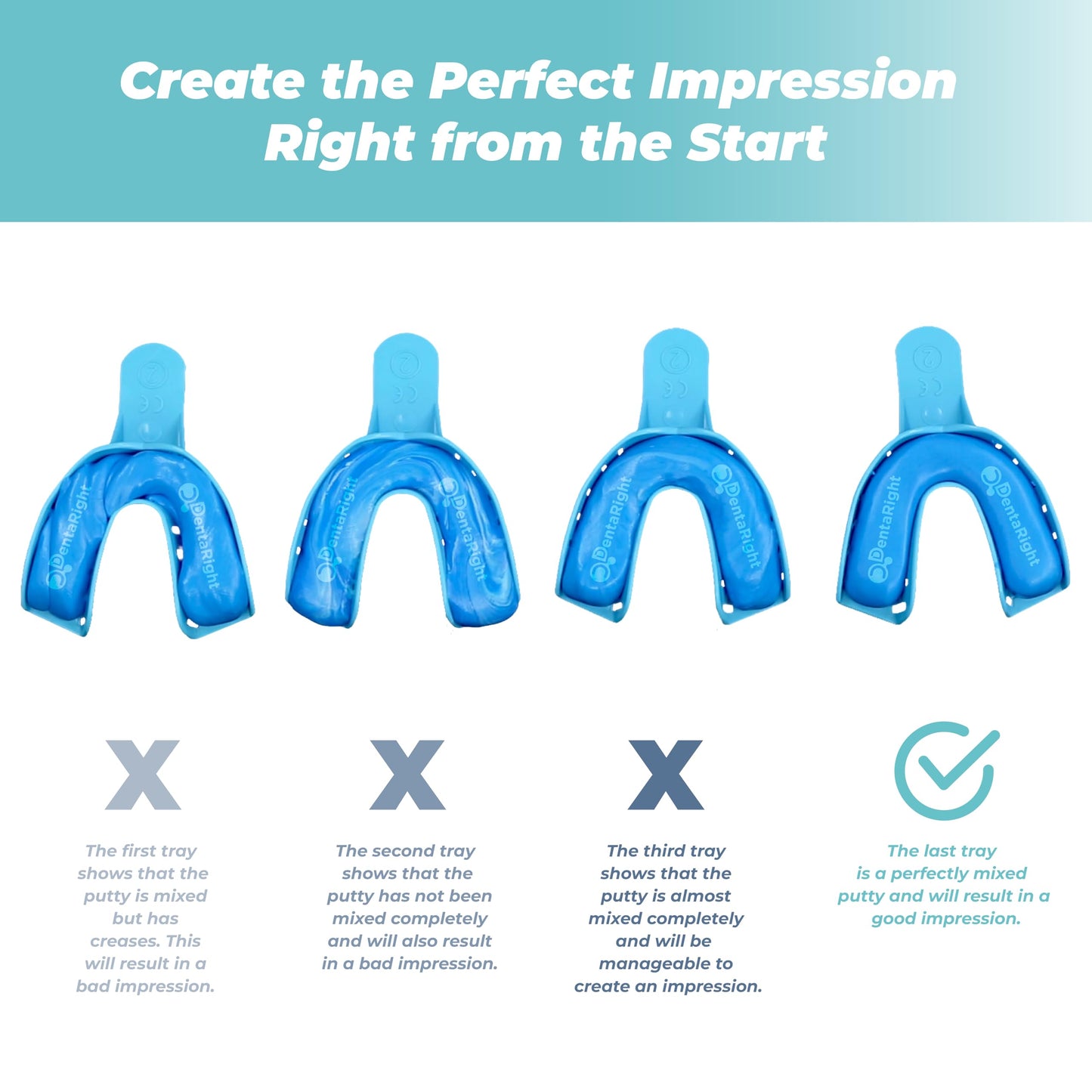 Mouth Guard for Teeth Grinding – Soft Custom-Fit Night Guard (1 Piece) – Upper or Lower