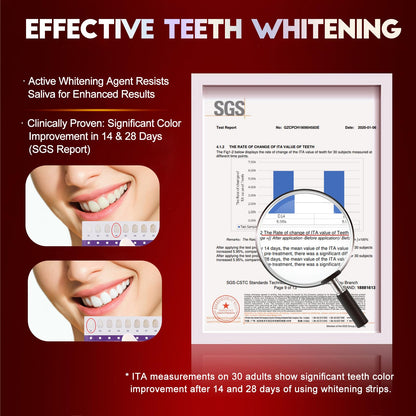 Teeth Whitening Strips – Dentist-Formulated, Enamel-Safe, 28 Strips