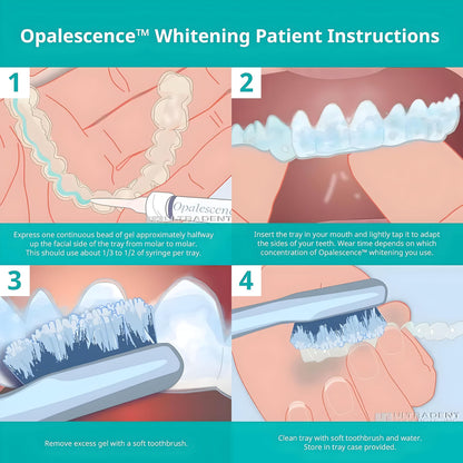Opalescence 10% Gel Teeth Whitening Refills (4 Syringes) Melon - Ultradent