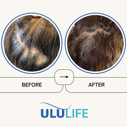 ULULIFE Ultimate Regrow Multivitamin – Hair Growth, Skin & Nails Health | 540 Capsules (90-Day Supply)