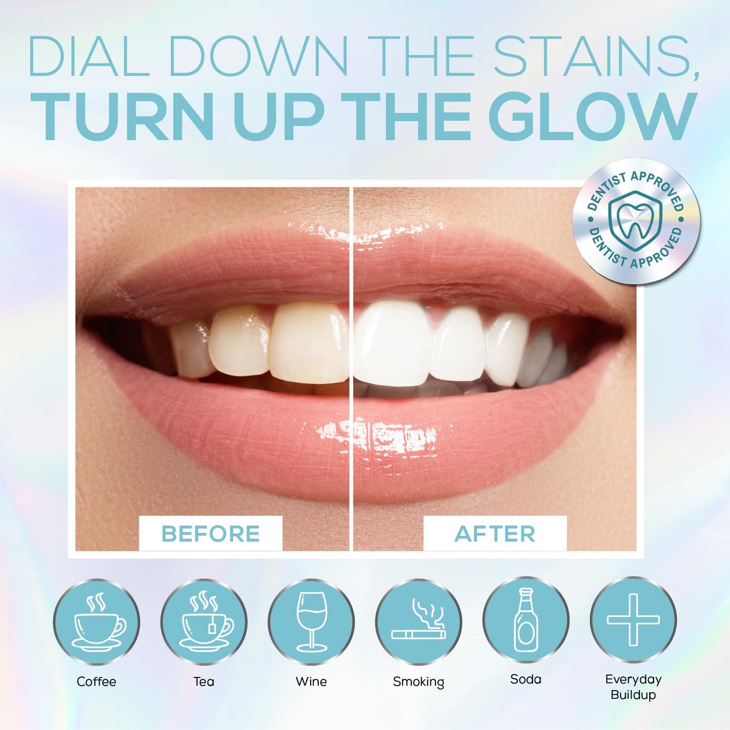 Venus Visage Teeth Whitening Kit with LED Light – 16-Min Non-Sensitive Whitening