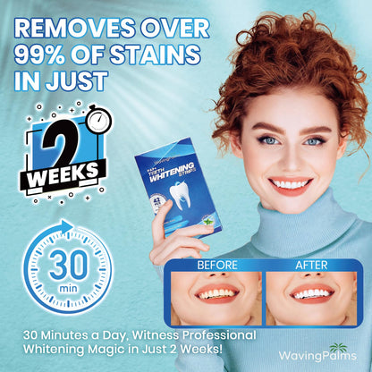 Professional Whitening Strips for Sensitive Teeth - Hydrogen Peroxide-Free Mint (42 Count)