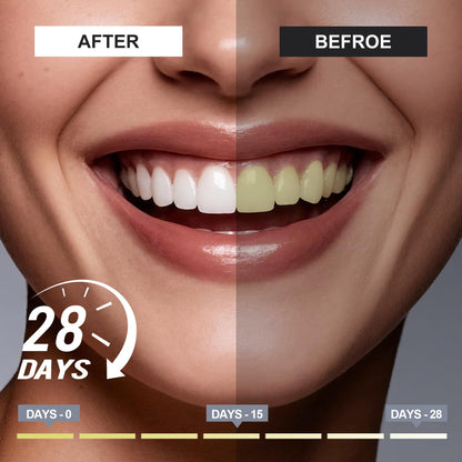 woadee 7.5% Hydroxyapatite Toothpaste for Advanced Enamel Protection, Fluoride-Free Nano Hydroxyapatite Toothpaste, Gentle and Effective Formula, Fresh Breath, Suitable for Sensitive Teeth 2 Pack