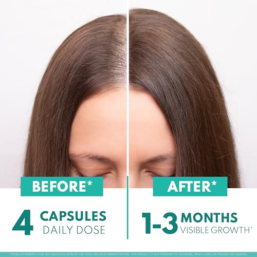 Superfood MD Women’s Balance Hair Growth – 2 Month Soy-Free Formula for 45+