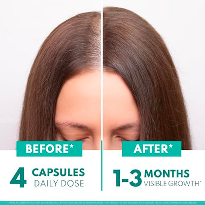 Superfood MD Women’s Balance Hair Growth – 2 Month Soy-Free Formula for 45+