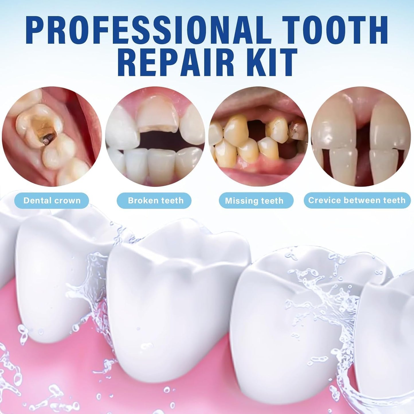 Zinc Oxide Eugenol Cement - Temporary Teeth Replacement Kit for Fillings & Crowns