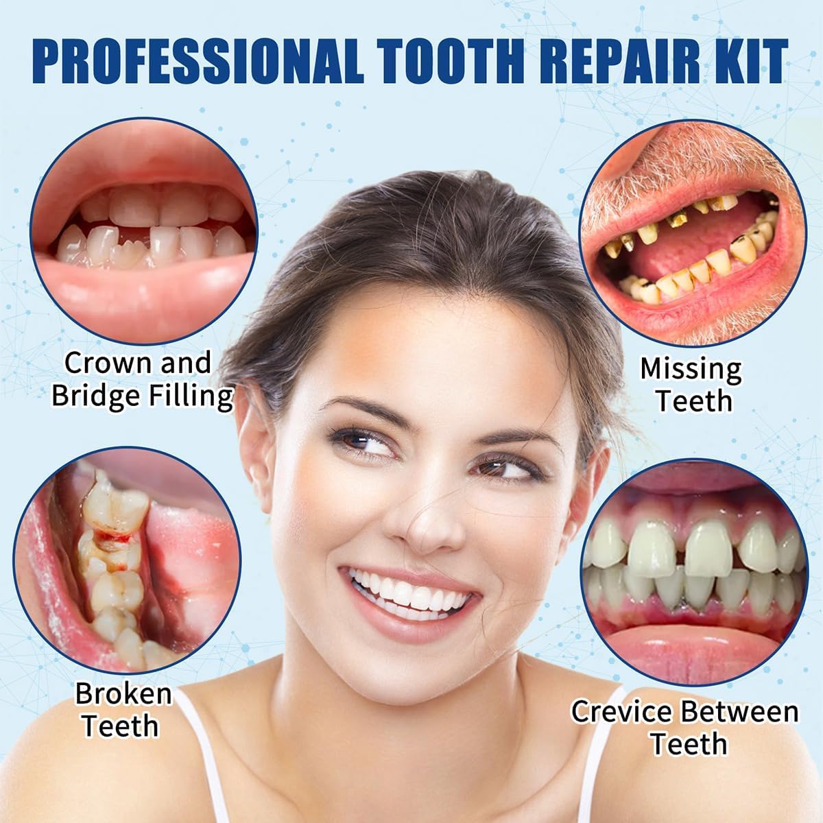 Zinc Oxide Eugenol Cement - Temporary Teeth Replacement Kit for Fillings & Crowns